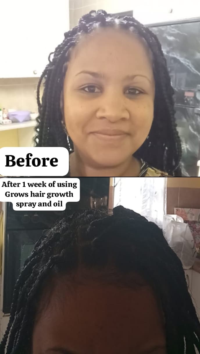 Customer-submitted before-and-after hair journey 1
